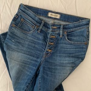Button Fly Madewell Jeans